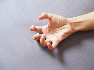 treating seizure disorders with marijuana